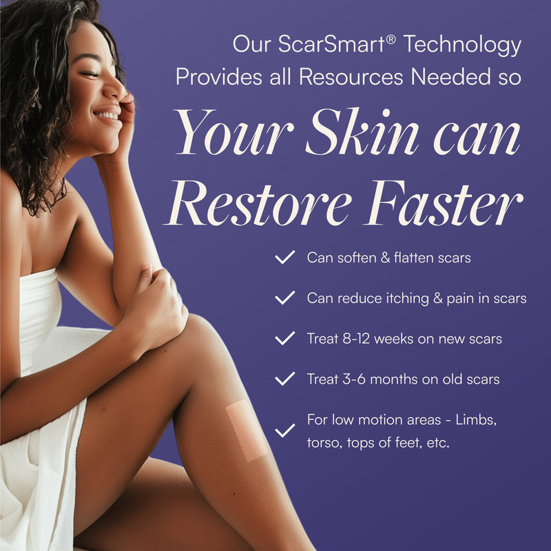 Scar Smart Silicone Scar Sheets